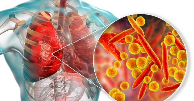 how respiratory pathogen samples are taken