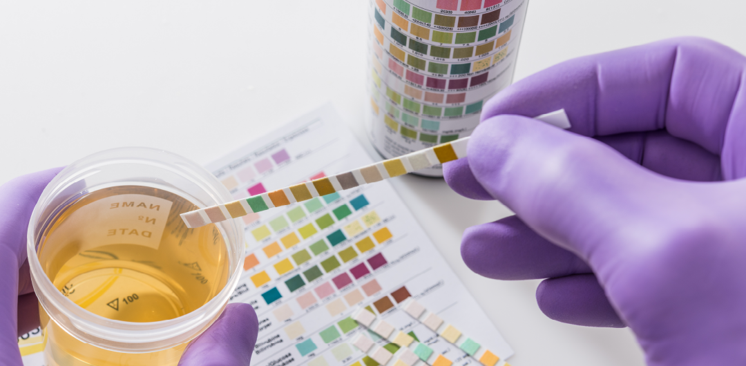 where should you go to get a urine test