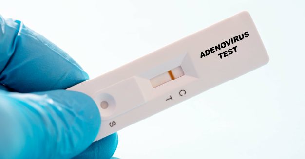 Adenovirus test