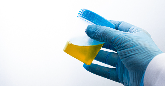 medical lab technician holding a sample 