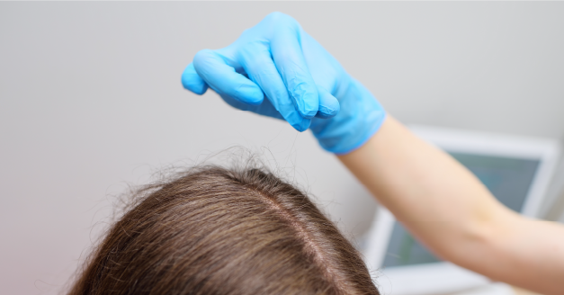 Specialist taking a hair sample