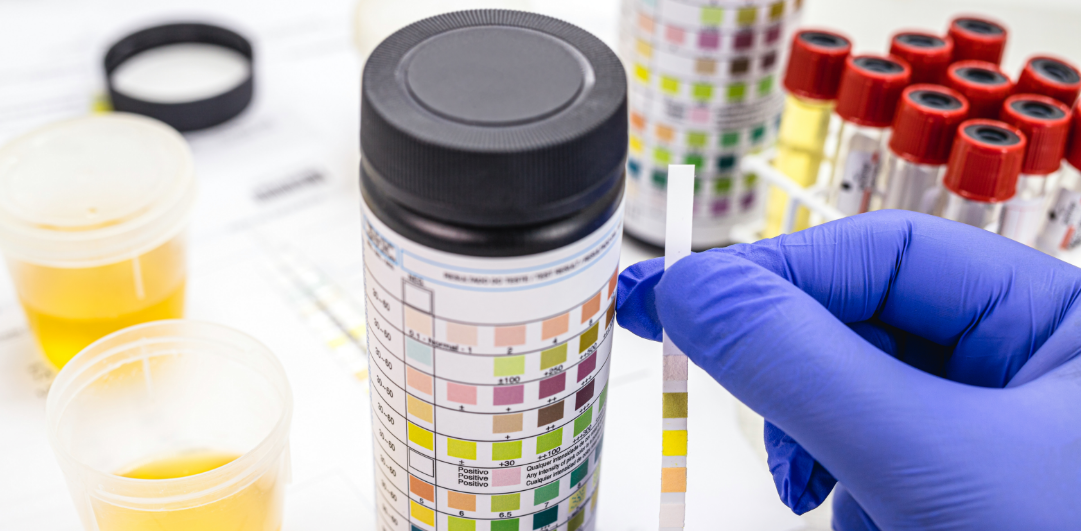 What is Tested in a Urine Toxicology Test?