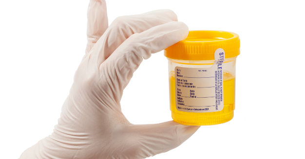 toxicology collection container 